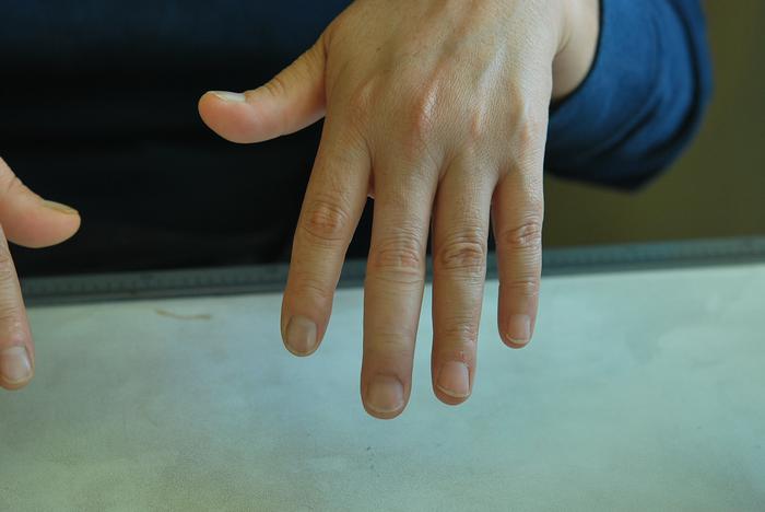 Prosthetic finger