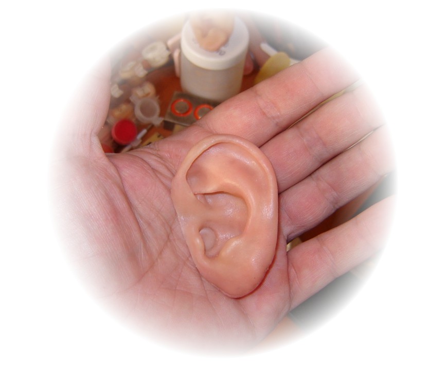 earlobe prosthesis
