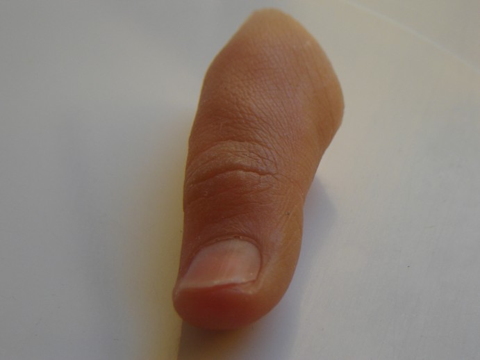 Protesis dedo pulgar1
