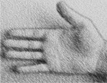 Pr&oacute;tesis mano hand