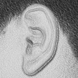 Protesis oreja ear