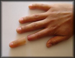 Finger prosthesis