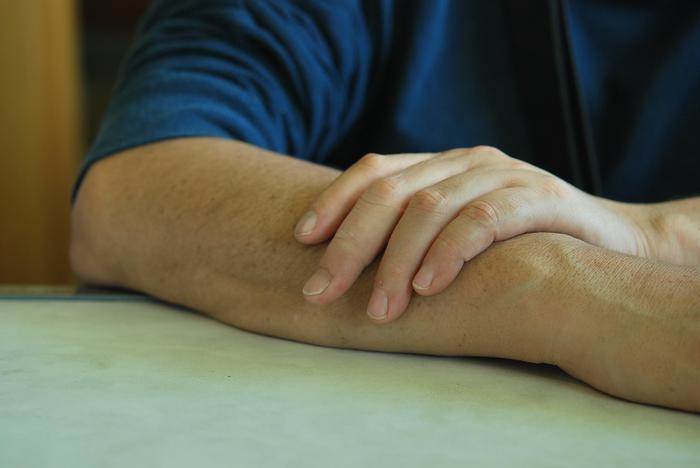 Prosthetic finger