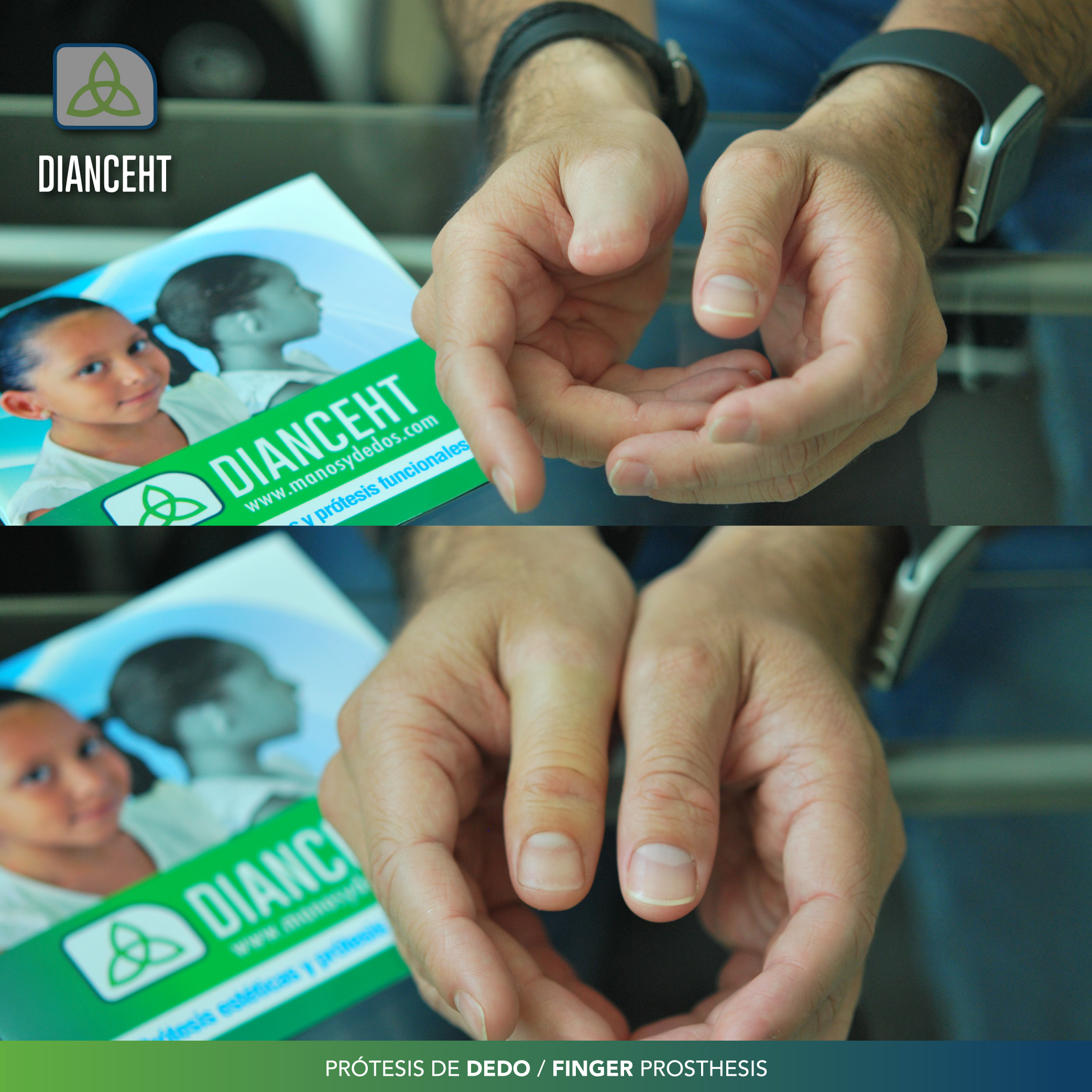 The hands of one of our artisans holding an ear prosthesis in one hand and a paintbrush in the other.