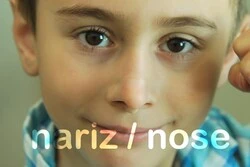 A child smiling directly at the camera with their nose prosthesis placed.