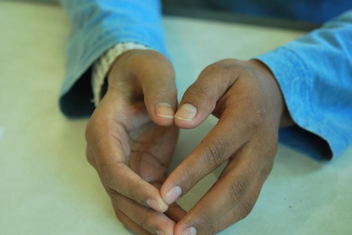 Prosthetic finger