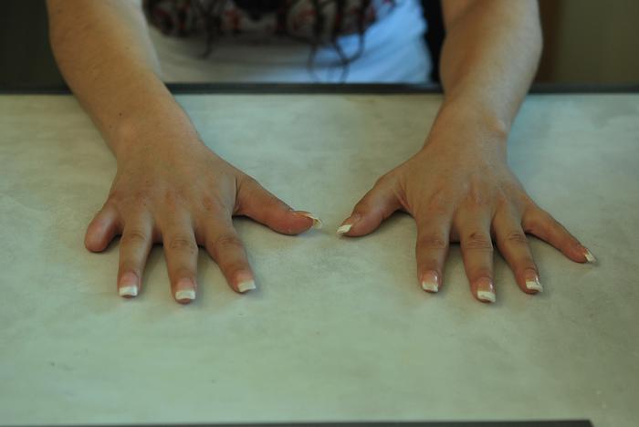 Prosthetic finger